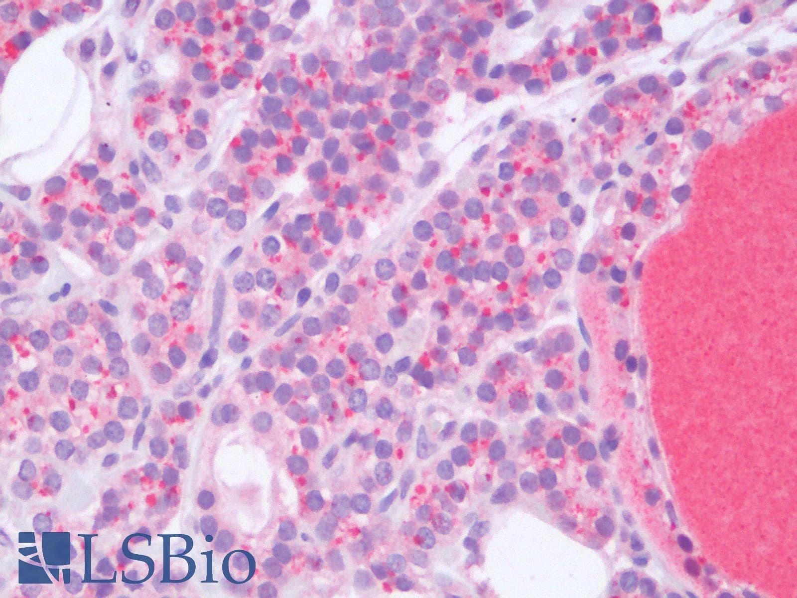 PathPlus™ HPSE / Heparanase Antibody