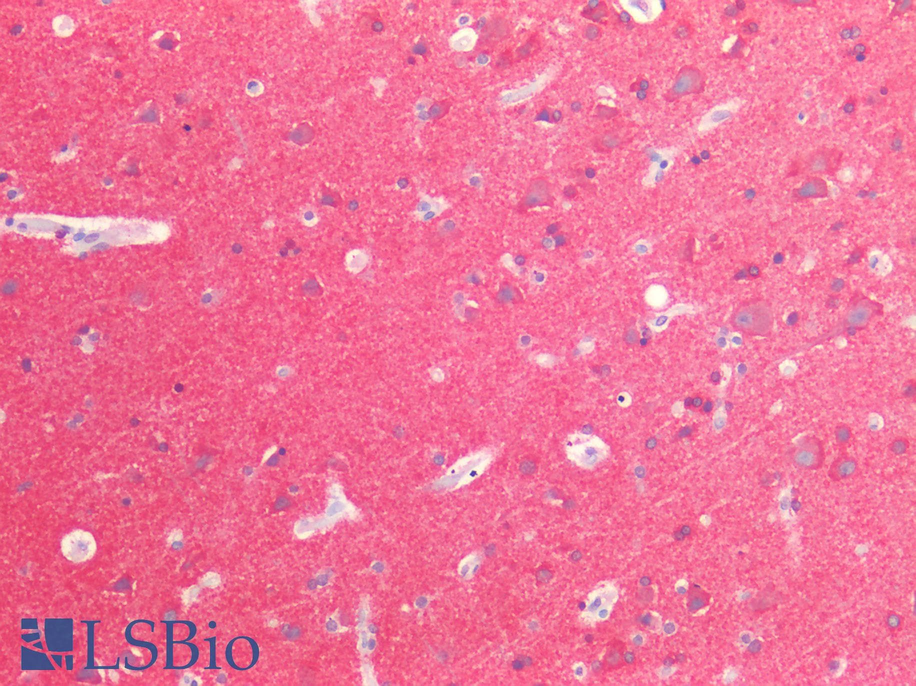 PathPlus™ MAPT / Tau Antibody