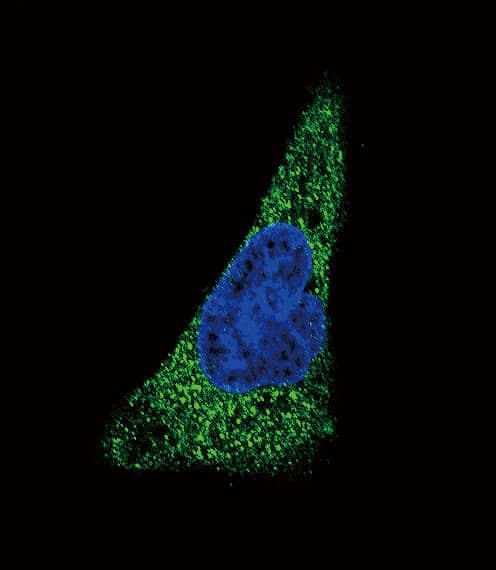 Polyclonal Rabbit anti-Human SLC11A2 / DMT1 Antibody (aa262-291, IF, WB)