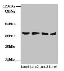 Polyclonal Rabbit anti-Human BABP / AKR1C2 Antibody (aa1-323, WB)