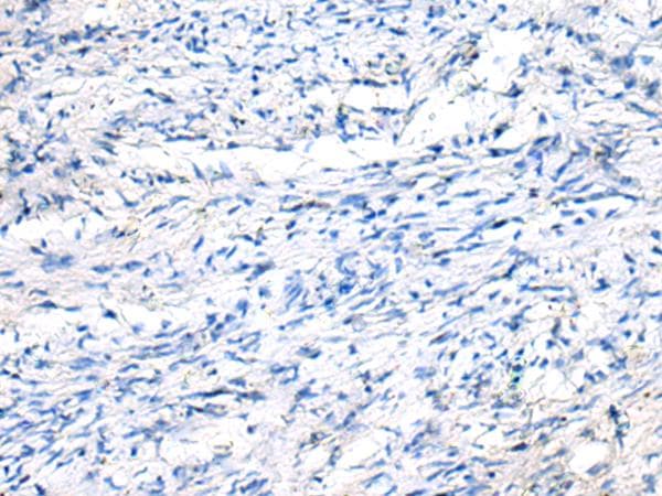 Polyclonal Rabbit anti-Human FGF11 / FGF-11 Antibody (IHC)