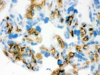 Polyclonal Rabbit anti-Human SLC4A1 / Band 3 / AE1 Antibody (aa28-365, IHC, WB)