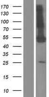 PDE9A Protein (Over-Expression Lysate Myc-DDK (Flag))