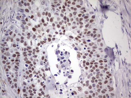 Monoclonal Mouse anti-Human IKZF3 / AIOLOS Antibody (clone OTI4C9, aa1-301, IHC, WB)