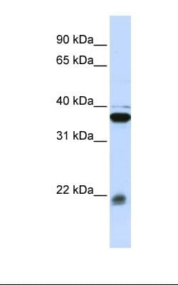 Polyclonal Rabbit anti-Human MLC2 / MYL9 Antibody (C-Terminus, IHC, WB)