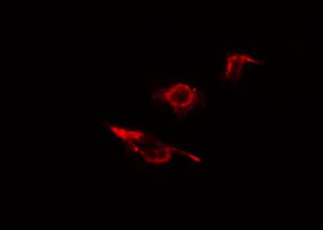 ADD2 Antibody