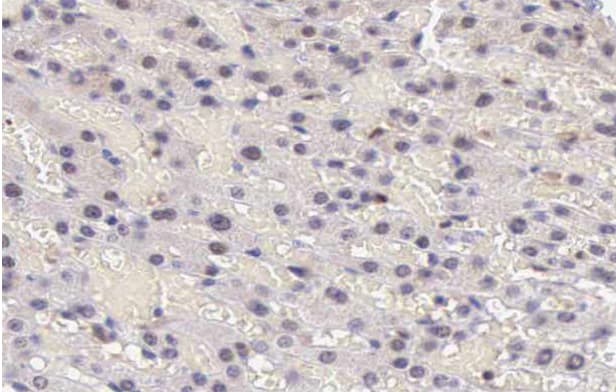 STAT5A Antibody (phospho-Tyr694)