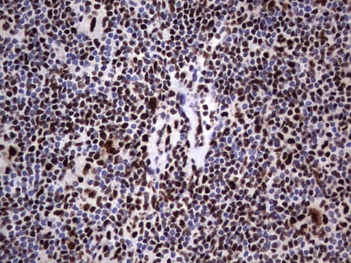 DDX56 Antibody (aa323-547, clone UMAB153)