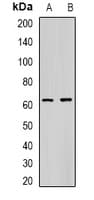 Carboxylesterase 1 / CES1 Antibody