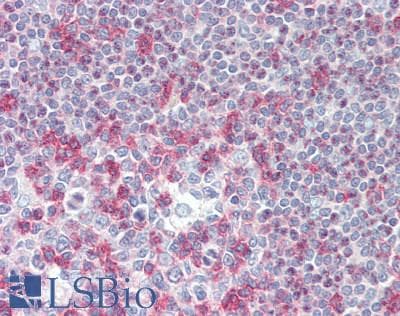 IHC-plus™ ICAM2 / CD102 Antibody (aa225-275)