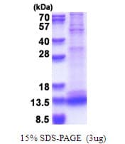 Human CASP3 / Caspase 3 Protein (Recombinant)