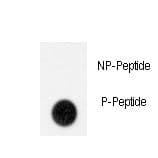 GIT1 Antibody (phospho-Tyr554)