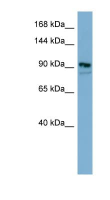 ESYT2 / E-Syt2 Antibody (aa611-660)