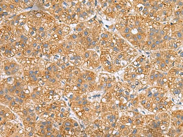 PPM1M Antibody