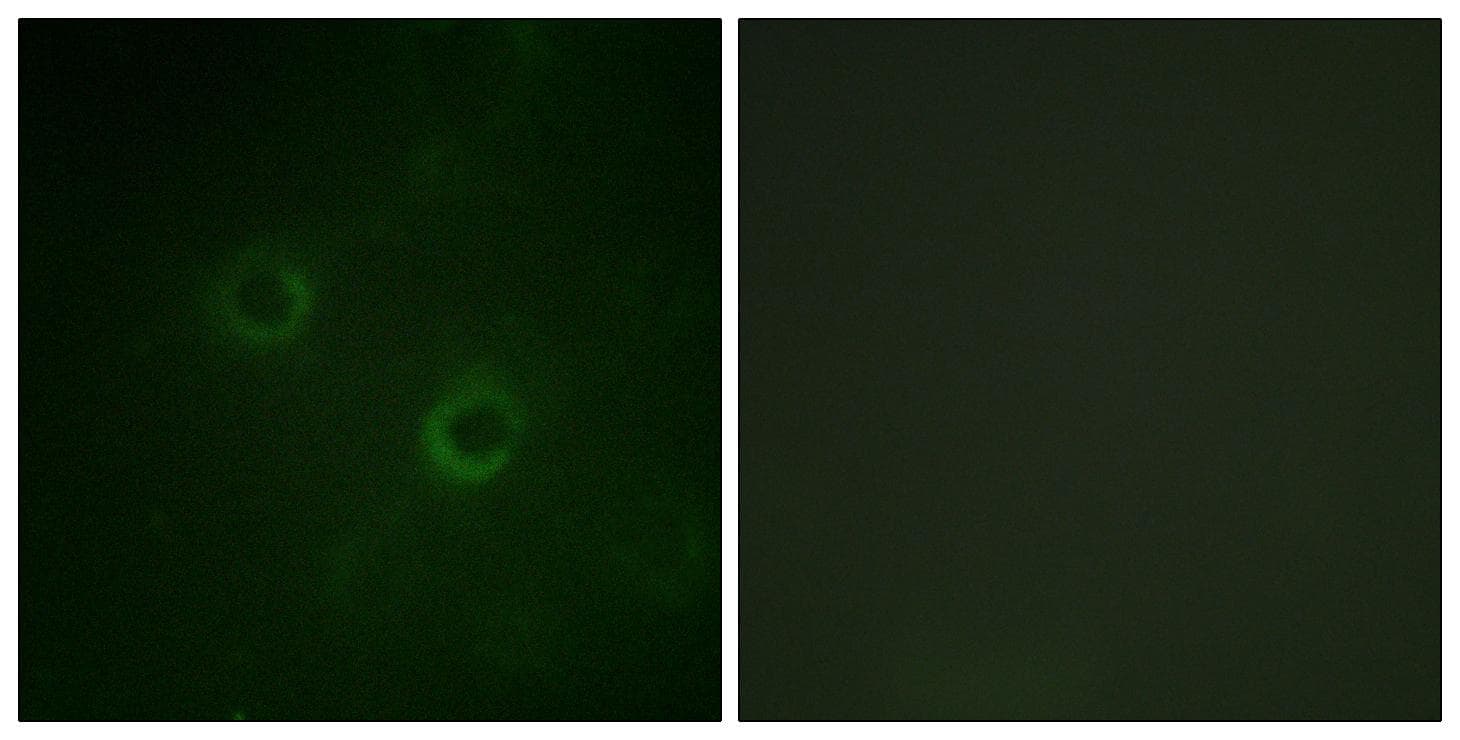 p56lck / LCK Antibody (p192)