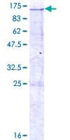 Human INT7 / INTS7 Protein (Recombinant GST)