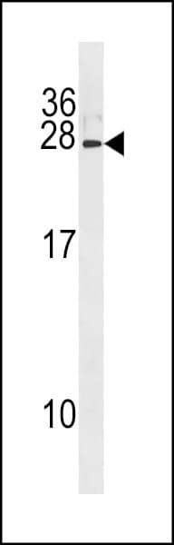 IFNA8 / Interferon Alpha 8 Antibody (aa163-189)