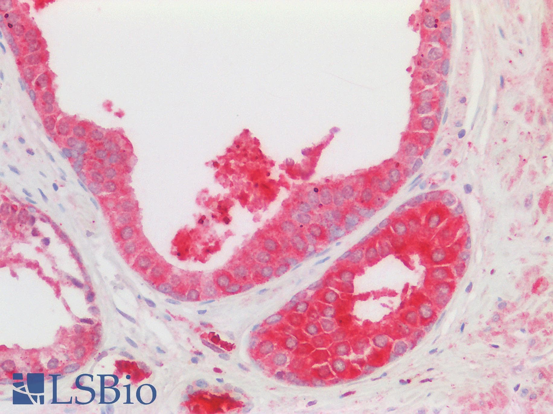 Polyclonal Rabbit anti-Human ALG11 Antibody (aa360-409, IHC, WB)