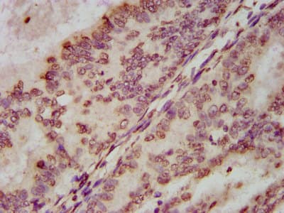 HIST1H3A Antibody