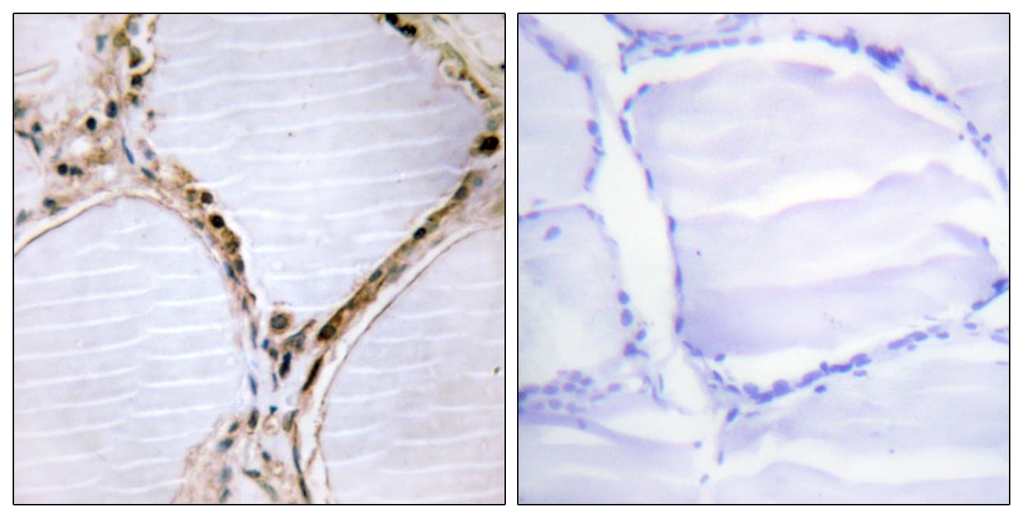 ETK / BMX Antibody (aa532-581)