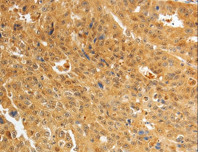 AKR1A1 Antibody