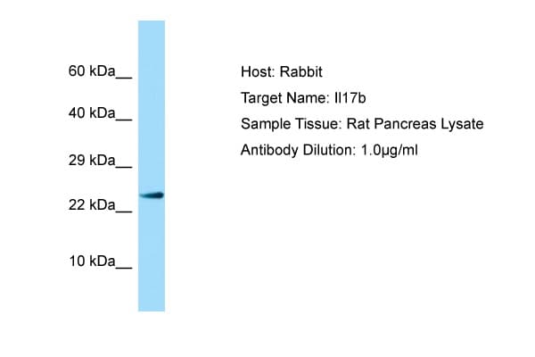 IL17B Antibody (N-Terminus)