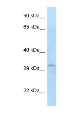 Polyclonal Rabbit anti-Human TIPRL / TIP Antibody (aa57-106, WB)