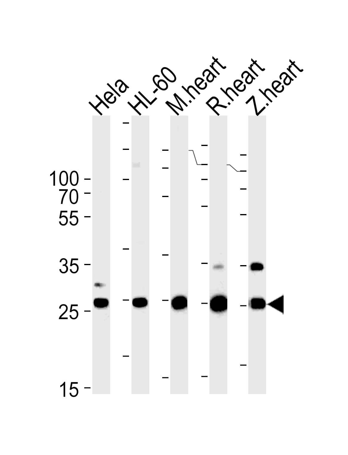 Polyclonal Rabbit anti-Zebrafish SDHB Antibody (aa137-162, WB)