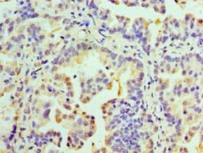 RMDN3 Antibody (aa1-470, FITC)