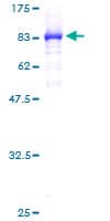 Human CCT5 / TCP1 Epsilon Protein (Recombinant GST)