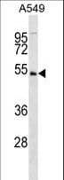 Polyclonal Rabbit anti-Human UHMK1 / KIS Antibody (aa1-30, IHC, WB)