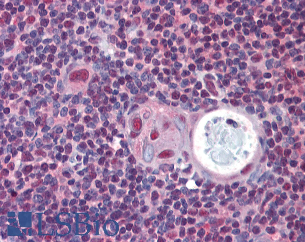 IHC-plus™ STK17B / DRAK2 Antibody (clone 2C3)