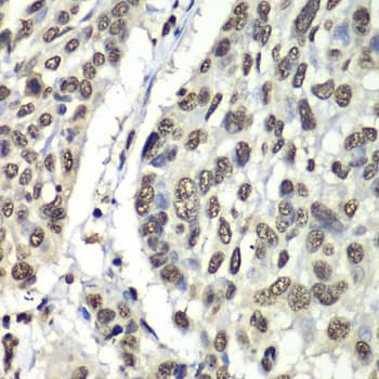 HNRPM / HNRNPM Antibody