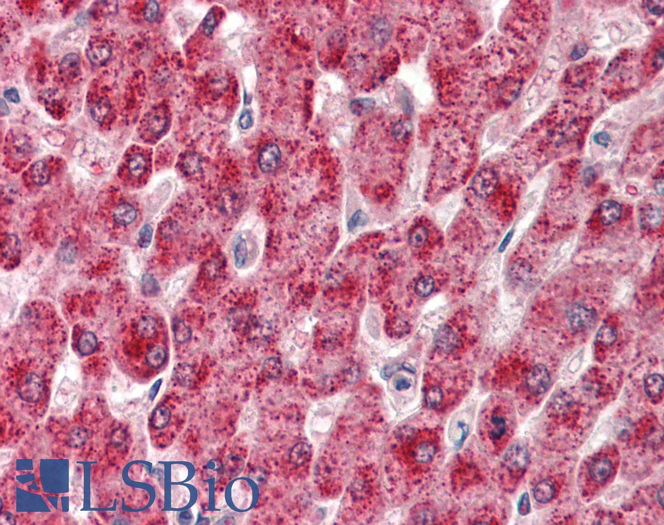 IHC-plus™ Polyclonal Goat anti-Human CYP2E1 Antibody (aa233-243, IHC, WB)