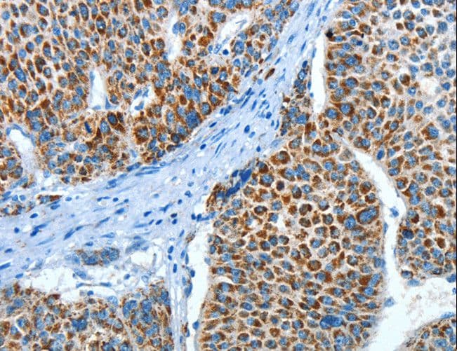 Polyclonal Rabbit anti-Human P5CDH / ALDH4A1 Antibody (IHC, WB)