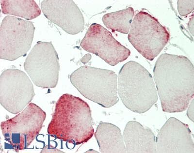 IHC-plus™ SCN8A / Nav1.6 Antibody (N-Terminus)