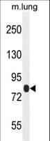 TTC30B Antibody (aa554-582)