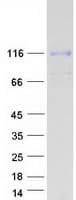 Human NEP / DDR1 Protein (Recombinant Myc-DDK (Flag))