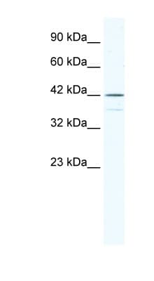 Polyclonal Rabbit anti-Human SOX3 Antibody (aa80-129, IHC, WB)