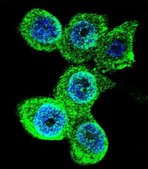 GALE / UDP-Glucose 4-Epimerase Antibody (aa142-171)