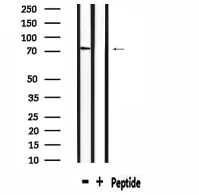 SLC6A8 Antibody