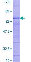 Human RFC3 Protein (Recombinant GST)