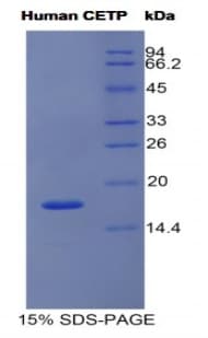 Human CETP Protein (Recombinant His)