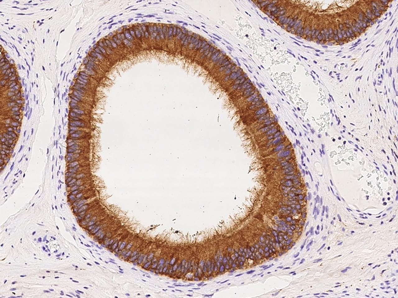 Polyclonal Rabbit anti-Human ELSPBP1 / HE12 Antibody (IHC)