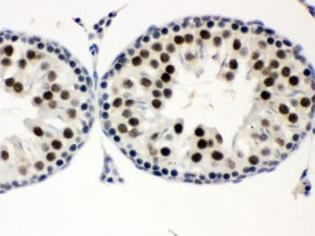MNAT1 Antibody