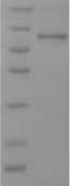 Human SPRR2B Protein (Recombinant 6His, N-terminus + Myc, C-terminus)