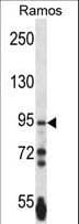 PCDHGA3 Antibody (aa284-311)