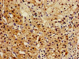 Polyclonal Rabbit anti-Human RGN / Regucalcin Antibody (IHC, IF, WB)