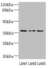 Polyclonal Rabbit anti-Human DNAJB2 Antibody (IHC, WB)