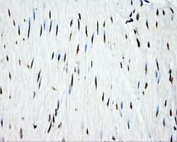 TLDC1 / KIAA1609 Antibody (clone OTI13H6)